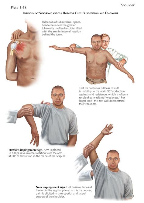 rotator cuff test vs impingement